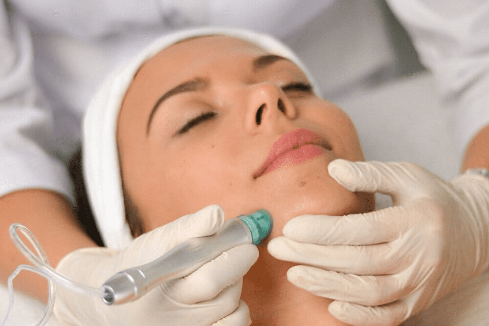 Hydrodermabrasion: A New Era for Skin Rejuvenation